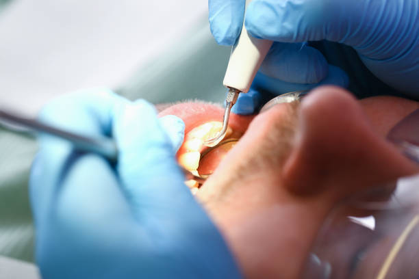 Best Pediatric Emergency Dentist in Tallmadge, OH